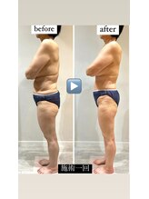 ビンナ 五反田店(Binna)/痩身筋膜リリース