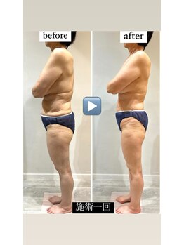 ビンナ 五反田店(Binna)/痩身筋膜リリース