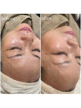 モンクラッシー(Mon classy)/一度で美白均一肌へ