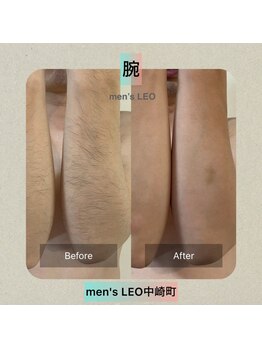 ランドマーク 中崎町(LANDMARK.)/《 腕 》