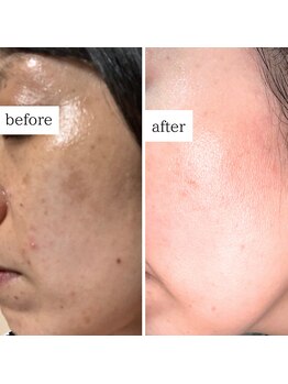 マーギアー(Magier)/ハーブ＋ダーマ