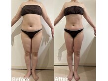 ヴィクシア(VIXIA)/痩身90分