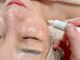 サロン ド ルパーク(salon de lepark)の写真/【リピート率94%/口コミ高評価◎シミケアコース】レーザーで効果実感できなかった方にもお勧めのシミケア♪