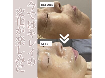 クラヴェル(Clavel)の写真