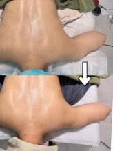 ルーチェ(LUCE)/ブライダル背中エステ