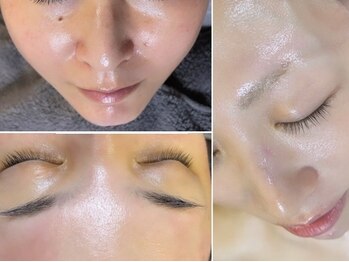 サロン エデンプラス(salon eden PLUS)/フェイシャル