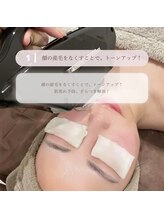 アムリリー 南草津店(AMRILY)/産毛に特化、顔脱毛