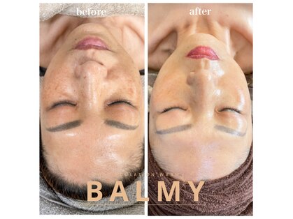 バーミー(BALMY)の写真