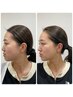 〈小顔〉たるみ・浮腫み徹底ケア！速攻性◎衰えた筋肉に驚きのリフトアップ★