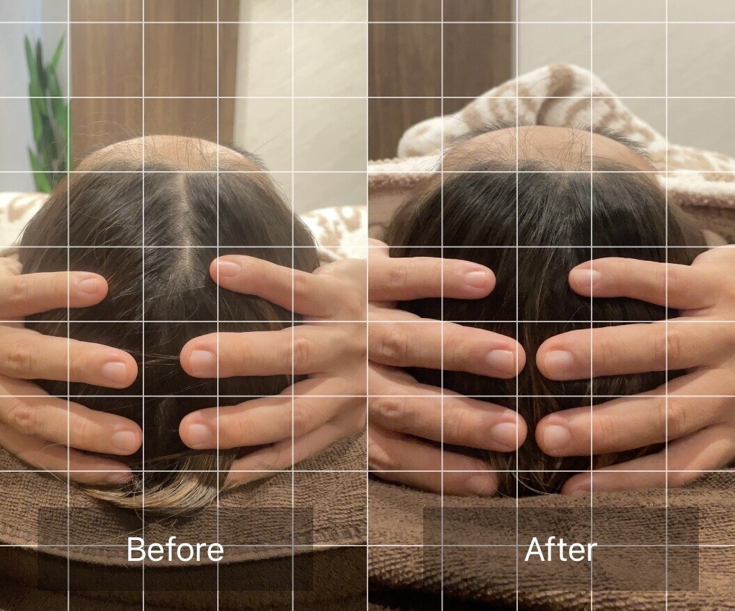 ゴクジョウ(GOKUJO)｜ホットペッパービューティー