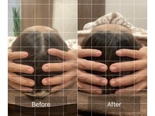 施術後　浮腫みの改善をサポート