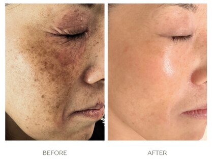 ラシェプリズ(LACHER PRISE)の写真