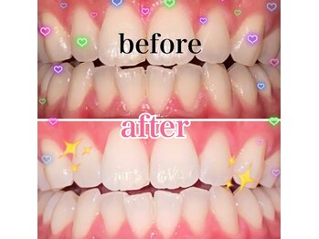 ダイヤモンドビューティー(DIAMOND BEAUTY)/大きなイベント前には!