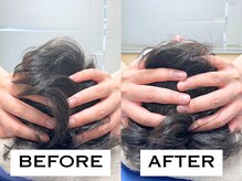 ビハリスト 新宿南口/頭のサイズからしっかり小顔に♪