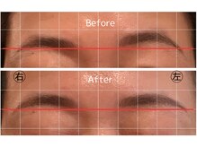 アレセ 表参道/眉毛位置矯正　ヘッドスパ