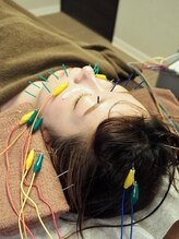 ビハダ(BIHADA)/エラ張りには微弱電流美容鍼☆彡