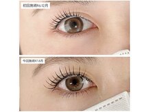 シア(Cia)/上下ラッシュリフト