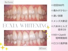 エクシアホワイトニング 六本木店