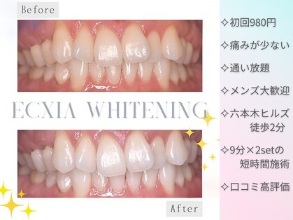 エクシアホワイトニング 六本木店の写真