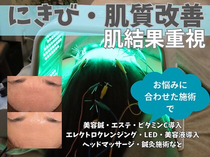 オンケイ(ONKEI)の写真