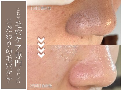 ベルエドゥース(Belle et Douce)の写真