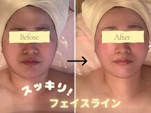 アイビジン 四日市店(I BiJiN)/お肌管理は任せてください