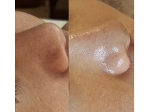 バリューネクスト 青葉台/◆最新ダクトピール◆LHA進化版