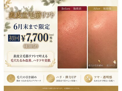 クレル(Clair)の写真