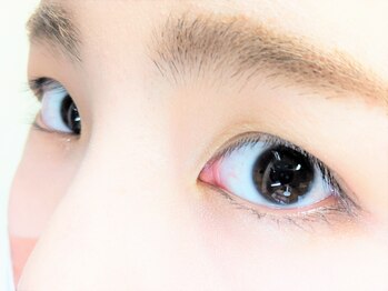 アイズ 深谷店(I's)/ビフォー施術前