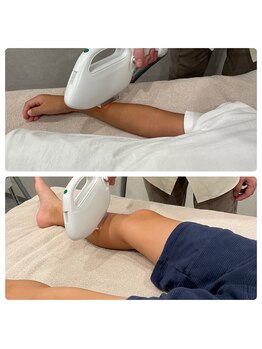 メンズレオ(Men’s Leo)/キッズ脱毛☆