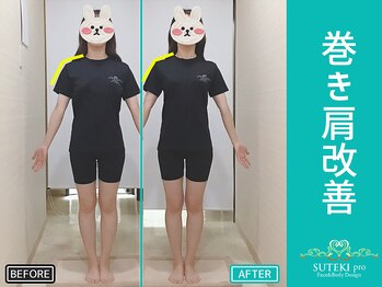 美骨矯正 ステキプロ(SUTEKI pro)/姿勢改善・肩幅・骨盤矯正