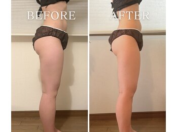 ヨサパーク アーバンヘブン 目黒(YOSA PARK Urban Heaven)/短期期間で集中ダイエット!