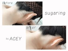 エイシー(ACEY)の雰囲気（シュガーリングならこんなに綺麗に！）