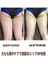 アルページュ(Arpege)/花嫁人気★セルケアMAXボディ