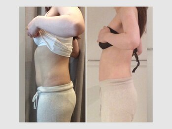 カロン 銀座(Kalon)/【腸もみ60分】10回結果！