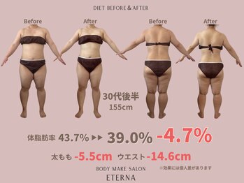 エテルナ(Eterna)/安城市　ダイエット　痩身エステ