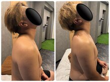 モアルポ 四日市(more repos)/初回体験のお客様のbefor＆after