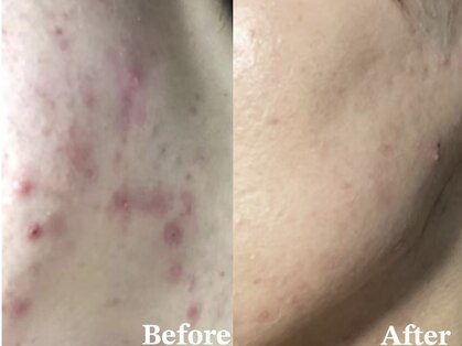 シャイネル(SHYNELL)の写真