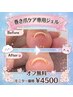 ★1日1人限定モニター価格★ オフ無料【韓国特許取得済み】巻き爪ケアジェル