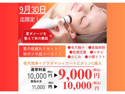 ビービー(BB)の写真