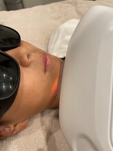 メンズレオ(Men’s Leo)/キッズ脱毛☆口周り&おでこ脱毛