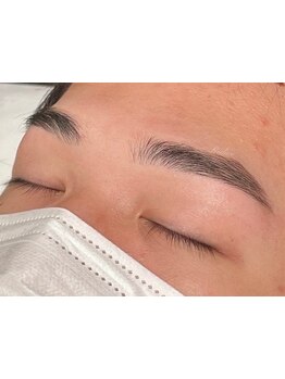 顔脱毛がしたい