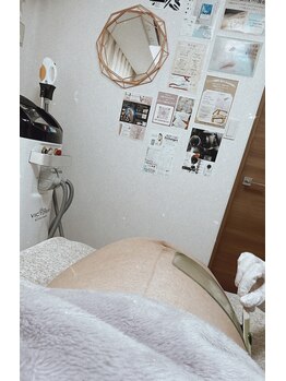 ミーミドットアイ(Mi-mi.i)/マタニティ脱毛