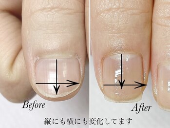 トゥインクリーネイルサロン(Twinkly Nail Salon)/【最強のネイルケア】1回お試し