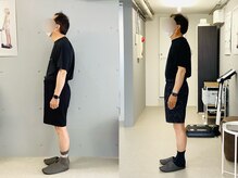 イレ 名古屋栄(ile)/60代、長年の猫背を根本から克服