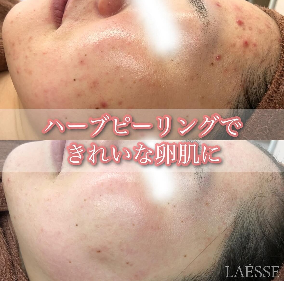 ラエッセ(LAESSE)｜ホットペッパービューティー