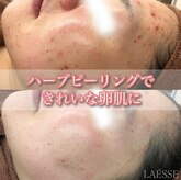 ラエッセ(LAESSE)