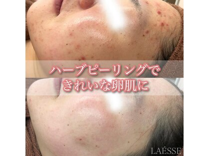 ラエッセ(LAESSE)の写真