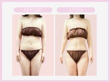 アコガレコガオ 八戸店/