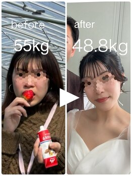 ハッチー(Hacchi)/【20代】ウェディング痩身！